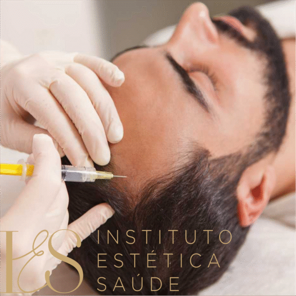 CURSO DE INTRADERMOTERAPIA CORPORAL E CAPILAR