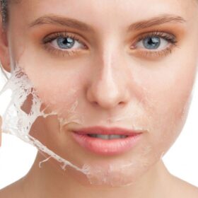 PEELING ESTÉTICO